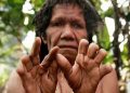 Finger Cutting of The Dani Tribe