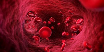 Blood Cancer Indonesia